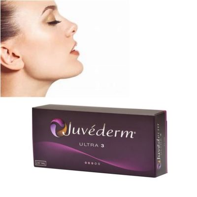 1.0ml ユベダーム 皮膚充填剤とヒアルロン酸ジェル ねじれと線を埋める