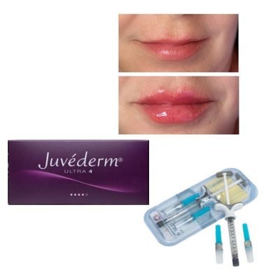 6~9ヶ月 Juvederm Dermal Filler Gel オンラインおよび店舗で購入可能