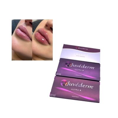 表面唇は皮膚注入口のJuvederm Ultra3のHyaluronic酸のゲルを架橋結合した