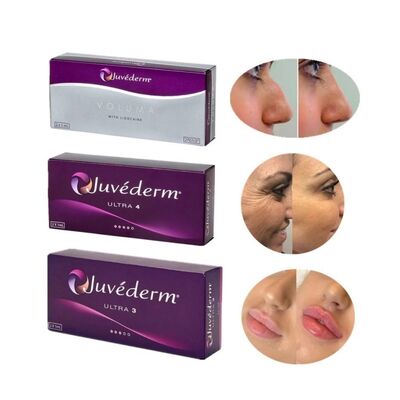 juvederm 耐久性のある注射性皮膚充填剤 保存期間 2年