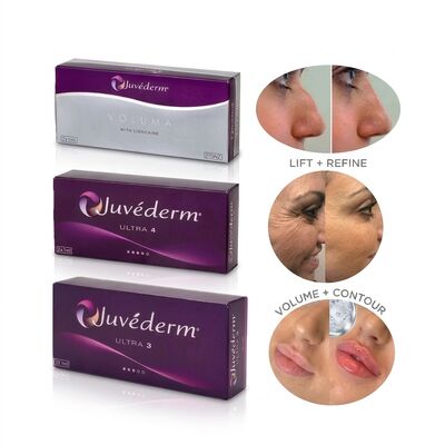 Juvederm Ultra 4 ナースフィラー ハイアルロン酸 皮膚フィルラー 非外科鼻整形 鼻の再塑造