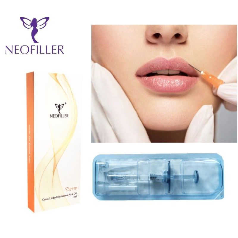 1ml ヒアルロン酸 皮膚充填剤 注射用ジェル 9~12ヶ月 自然な若返り 顔の美化