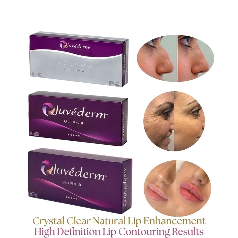 注射器の容量 2 1ml 箱あたり Juvederm Voluma Filler 安全 顔 形状 容量 増強のための注射用皮膚フィルラー