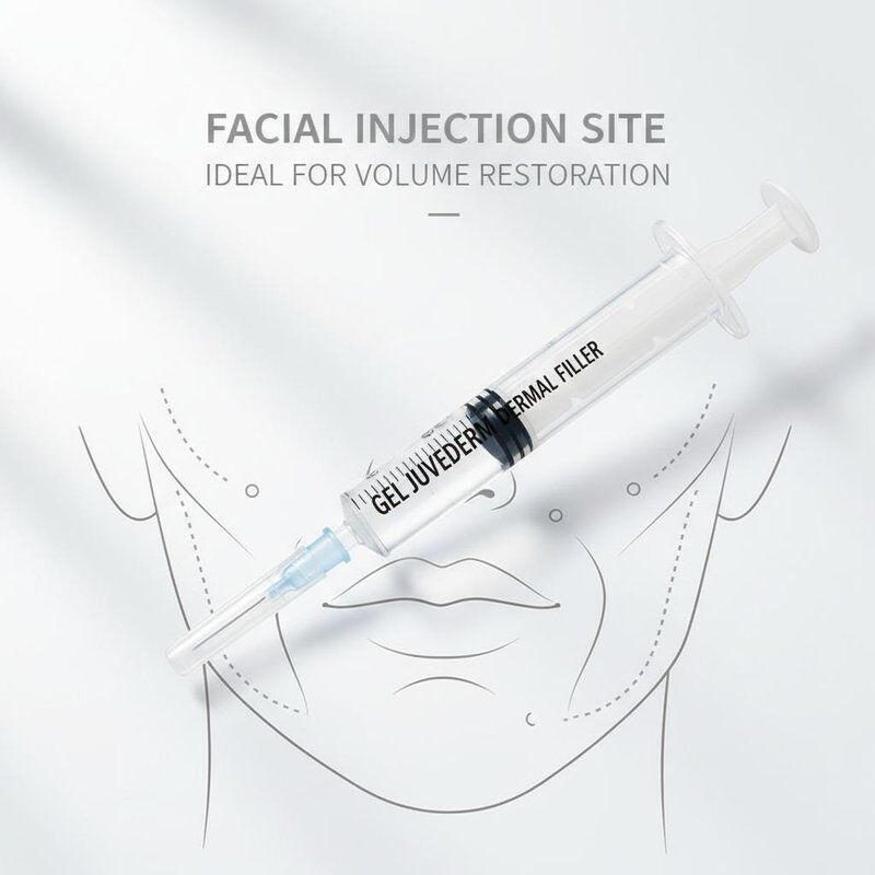 ゲル ジュベダーム 皮膚充填剤 1ml 注射器 顔の注射場 顔の若返しと体積回復の手術に最適